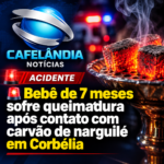 Bebê de 7 meses sofre queimadura após contato com carvão de narguilé em Corbélia